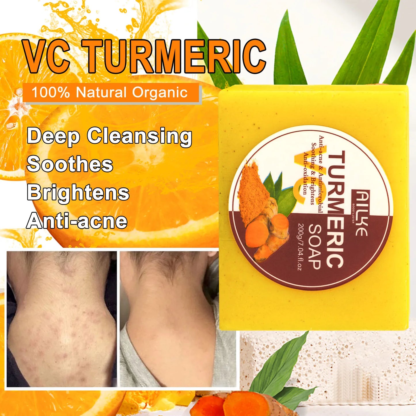 AILKE Organic Turmeric Skin Care Set for Acne and Skin Tone