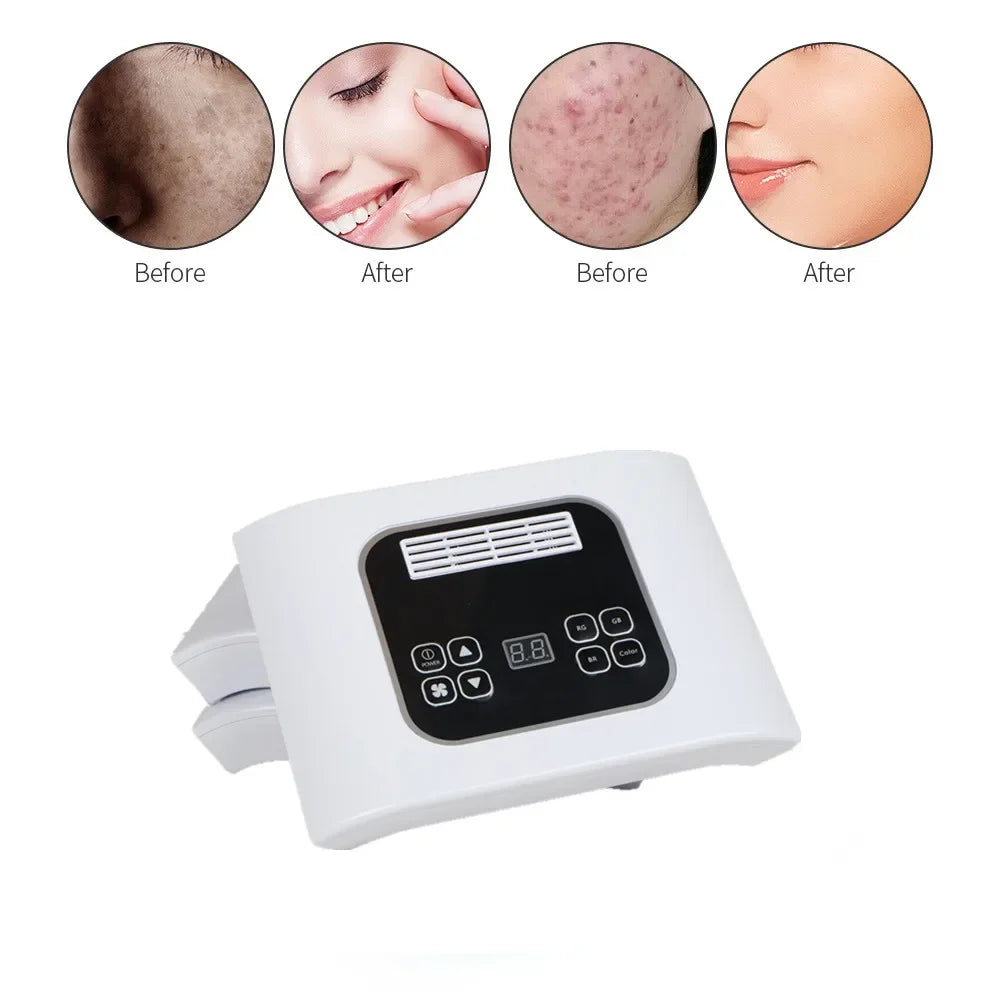 LED Photon Mask for Acne Treatment and Skin Rejuvenation