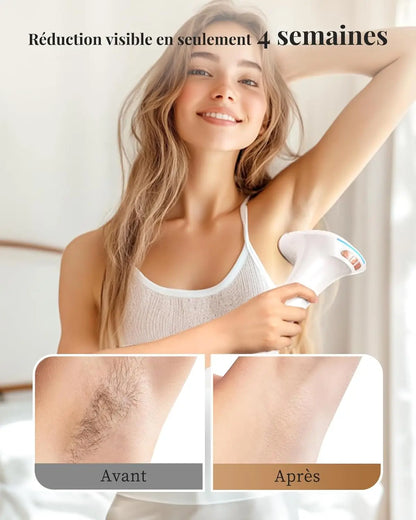 Home IPL Laser Hair Removal System for Painless Hair Removal