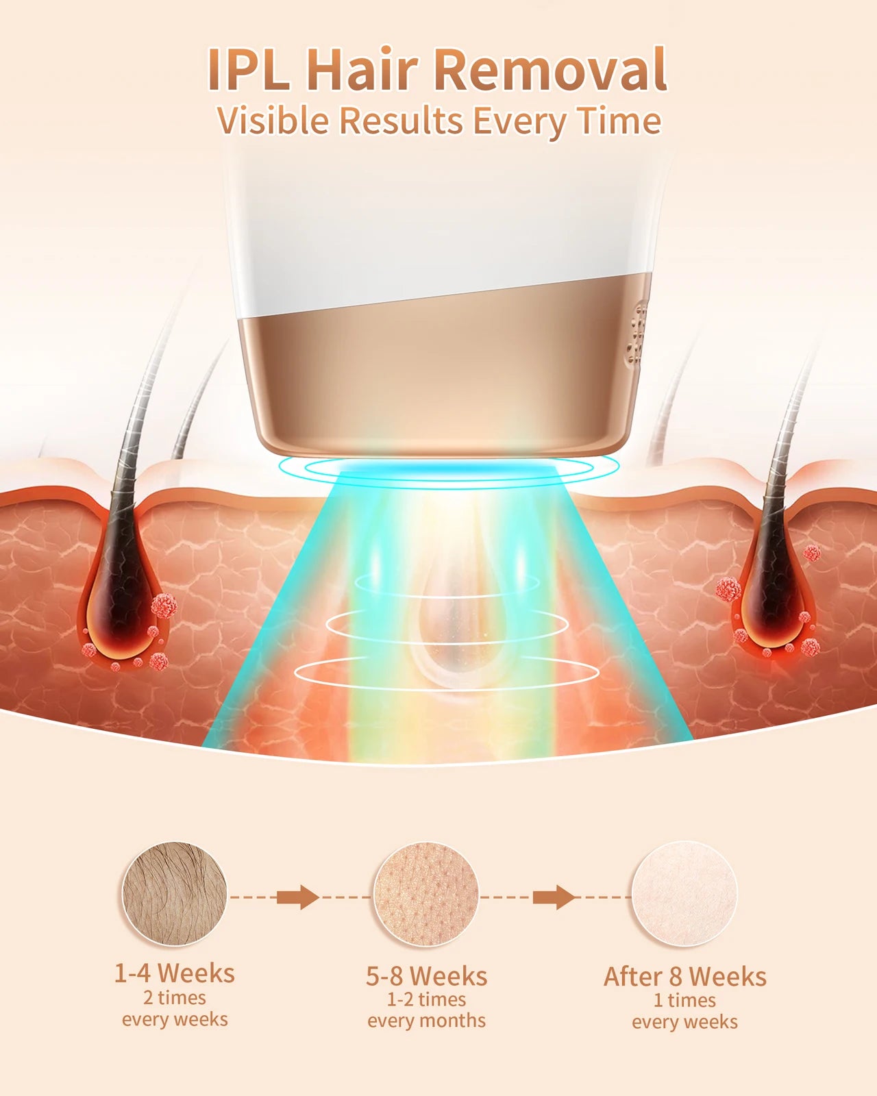 IPL Hair Removal Laser for Permanent Painless Hair Removal